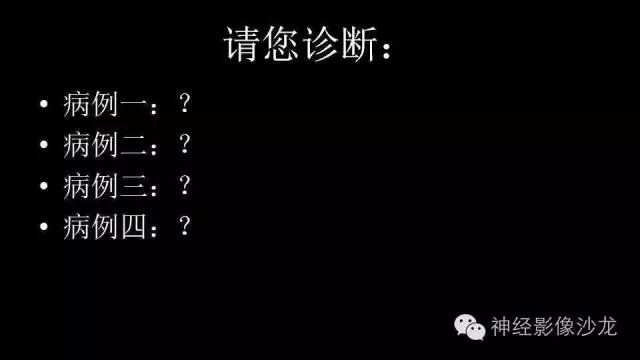 【病例】这四类脑室内肿瘤,您了解么? 【病例】这四类脑室内肿瘤,您了解么?