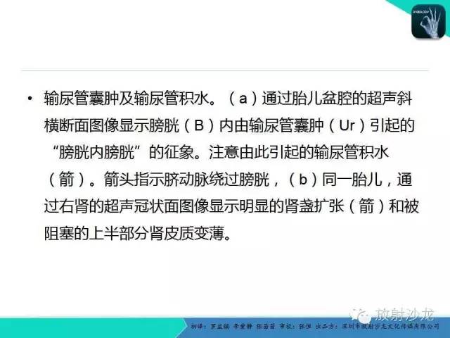【PPT】胎儿卵巢囊肿：成像序列、鉴别诊断、治疗和结局综述
