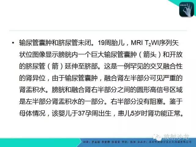 【PPT】胎儿卵巢囊肿：成像序列、鉴别诊断、治疗和结局综述