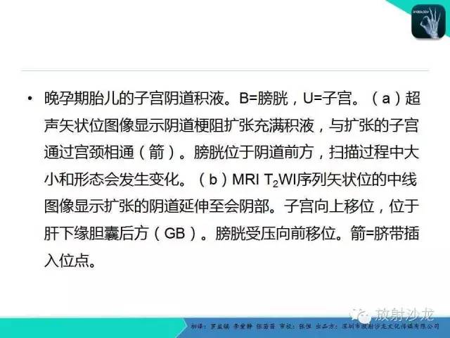 【PPT】胎儿卵巢囊肿：成像序列、鉴别诊断、治疗和结局综述
