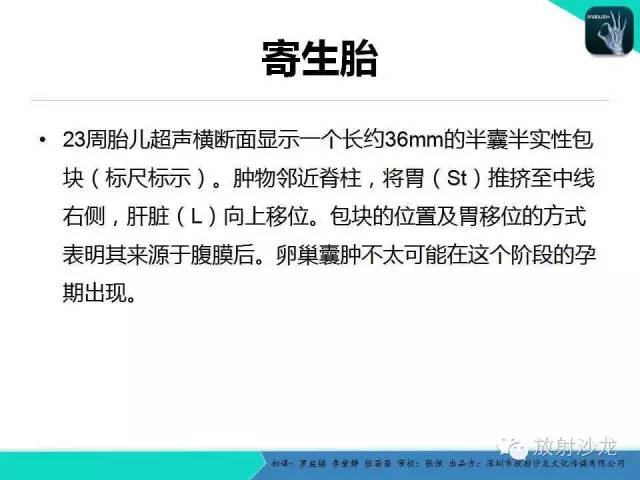 【PPT】胎儿卵巢囊肿：成像序列、鉴别诊断、治疗和结局综述
