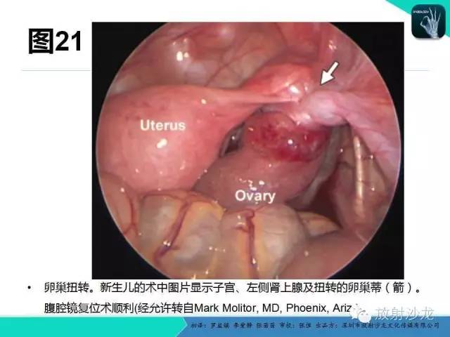 【PPT】胎儿卵巢囊肿：成像序列、鉴别诊断、治疗和结局综述