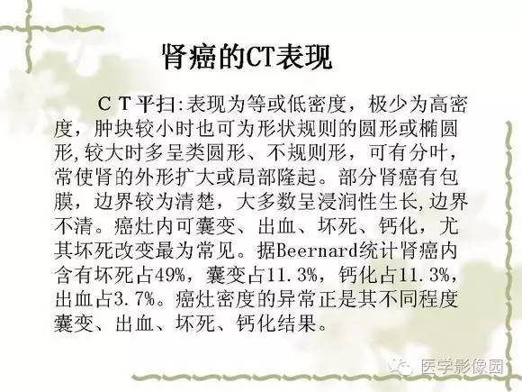 【PPT】肾癌的影像学表现