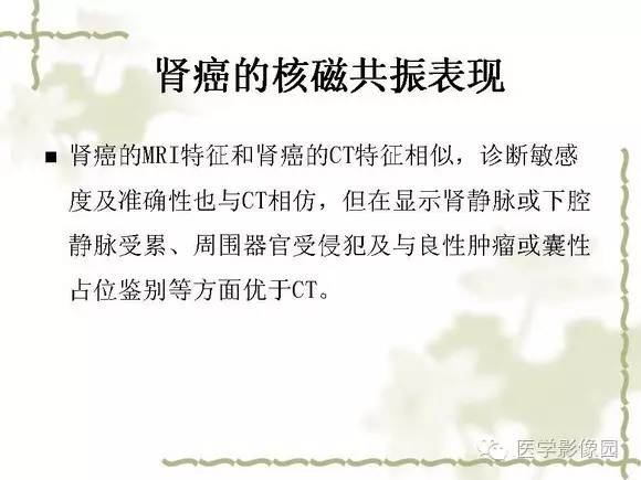 【PPT】肾癌的影像学表现