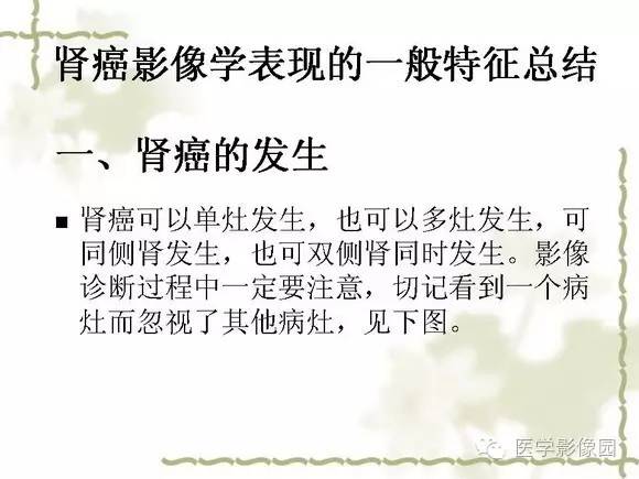 【PPT】肾癌的影像学表现
