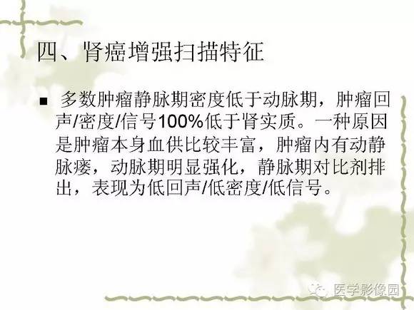 【PPT】肾癌的影像学表现