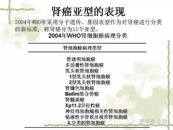 【PPT】肾癌的影像学表现