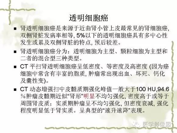 【PPT】肾癌的影像学表现