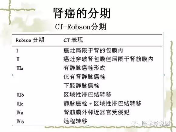 【PPT】肾癌的影像学表现