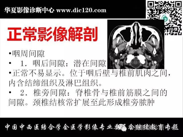 【PPT】鼻咽部疾病影像诊断与鉴别