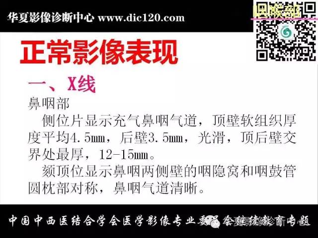 【PPT】鼻咽部疾病影像诊断与鉴别