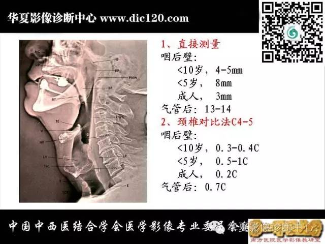 【PPT】鼻咽部疾病影像诊断与鉴别
