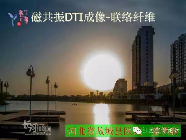 【PPT】磁共振DTI成像—联络纤维