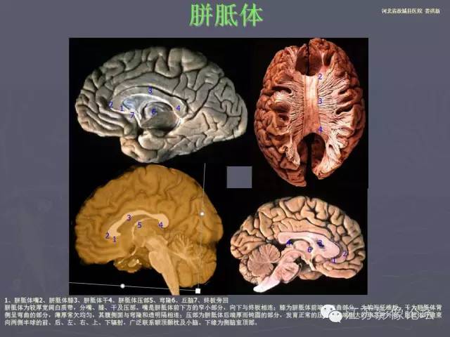 【PPT】磁共振DTI成像—联络纤维