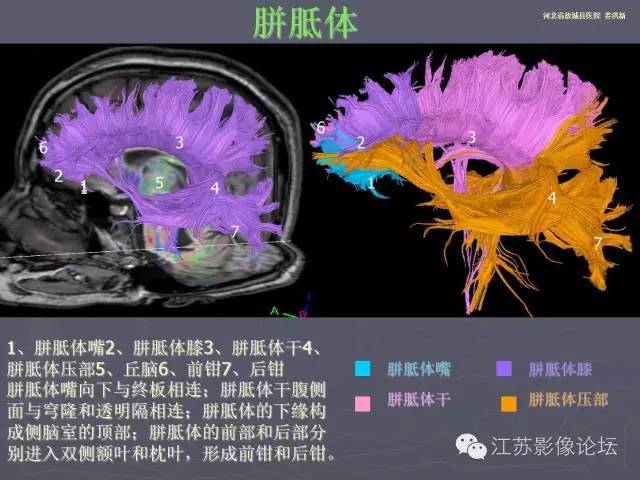 【PPT】磁共振DTI成像—联络纤维