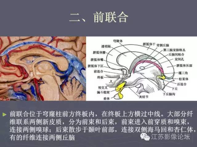 【PPT】磁共振DTI成像—联络纤维