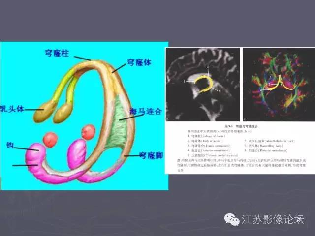 【PPT】磁共振DTI成像—联络纤维