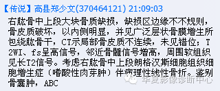 【病例】肱骨嗜酸性肉芽肿1例影像表现
