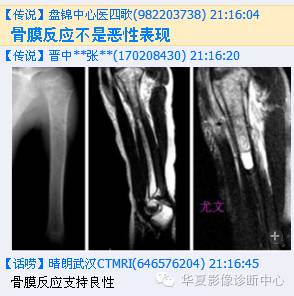 【病例】肱骨嗜酸性肉芽肿1例影像表现