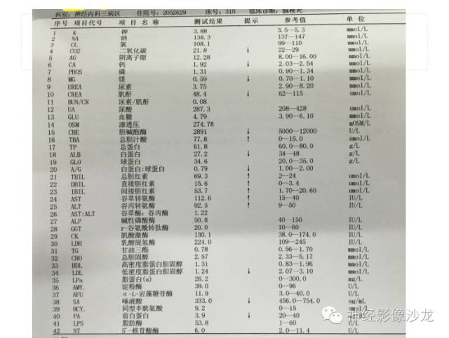 【病例】肝性脑病1例CT及MR影像表现