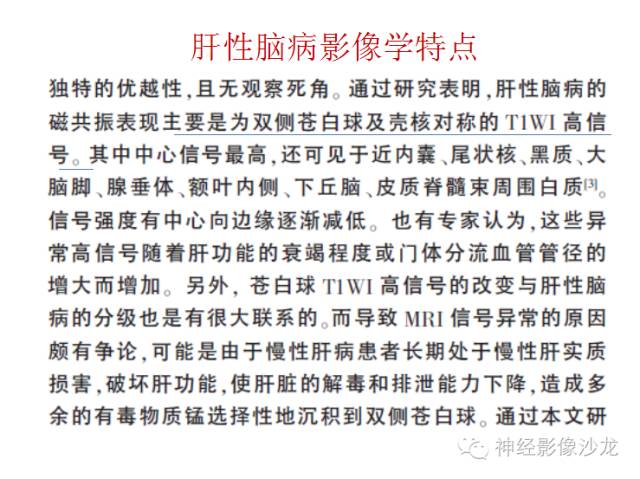 【病例】肝性脑病1例CT及MR影像表现