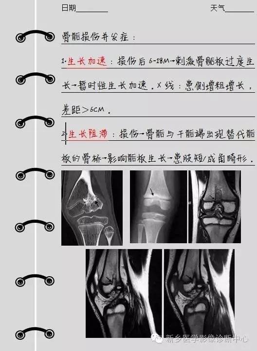 骨骺损伤后，该：变长？还是变短？