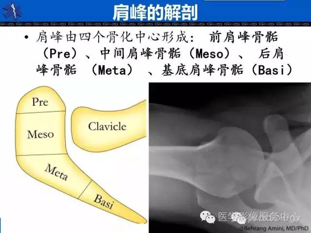 【PPT】80%的医生都不知道的肩峰骨
