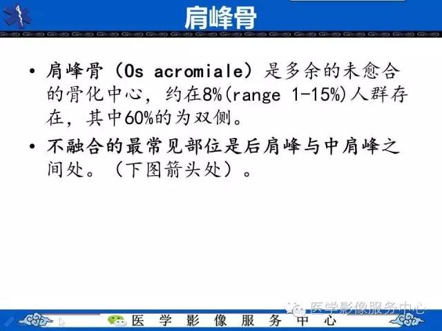 【PPT】80%的医生都不知道的肩峰骨