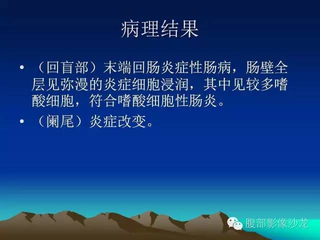 【病例】嗜酸性肠炎1例CT影像表现 【病例】嗜酸性肠炎1例CT影像表现