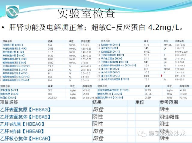 【病例】肝脏淋巴瘤1例CT及MR影像表现 【病例】肝脏淋巴瘤1例CT及MR影像表现