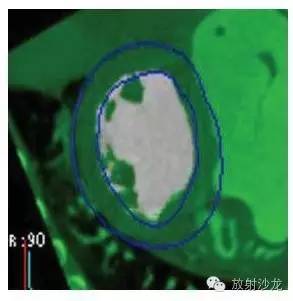 放射科医生必须掌握的心脏MRI和CT生理学 放射科医生必须掌握的心脏MRI和CT生理学