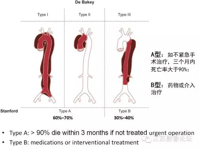 【PPT】急诊室经常遇到的急性主动脉疾病 【PPT】急诊室经常遇到的急性主动脉疾病