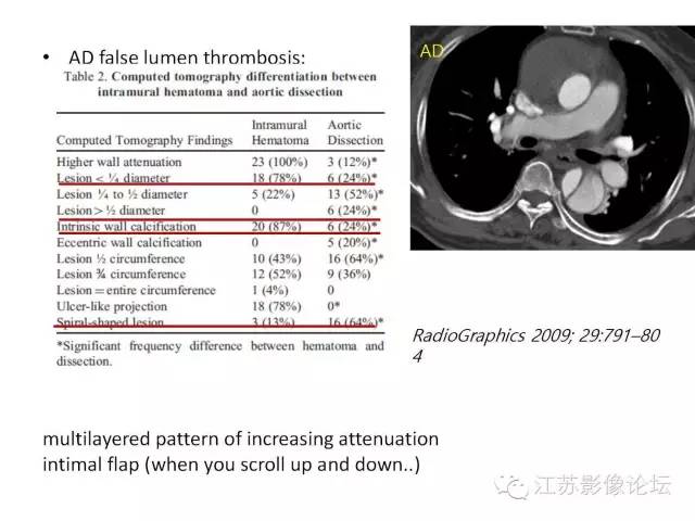 【PPT】急诊室经常遇到的急性主动脉疾病 【PPT】急诊室经常遇到的急性主动脉疾病