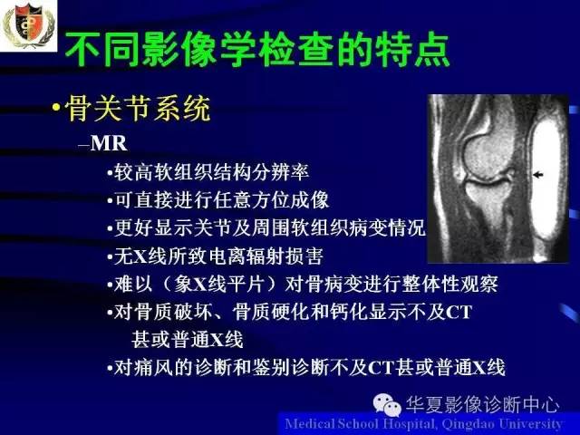 【PPT】痛风影像学检查及诊断