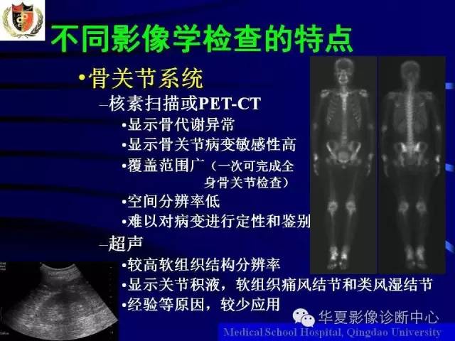 【PPT】痛风影像学检查及诊断