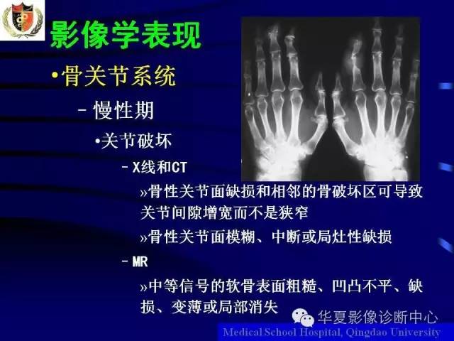 【PPT】痛风影像学检查及诊断