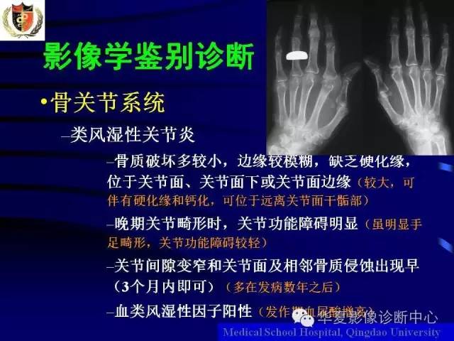 【PPT】痛风影像学检查及诊断