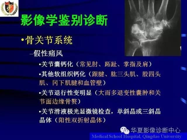 【PPT】痛风影像学检查及诊断