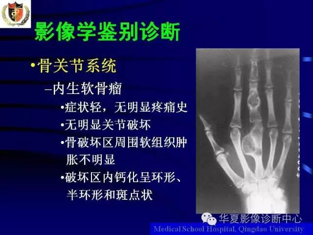 【PPT】痛风影像学检查及诊断