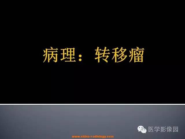 【病例】小脑囊性转移瘤1例MR影像表现