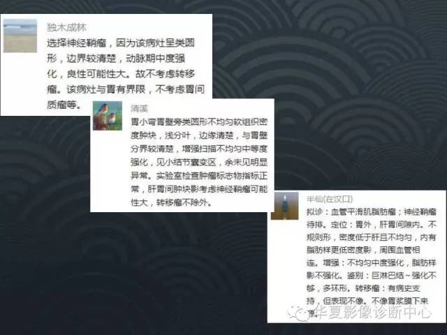 【病例】腹膜后神经鞘瘤1例CT影像表现