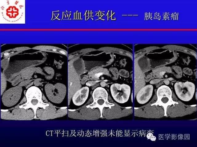 【PPT】MRI在腹部实质脏器病变诊断中的优势