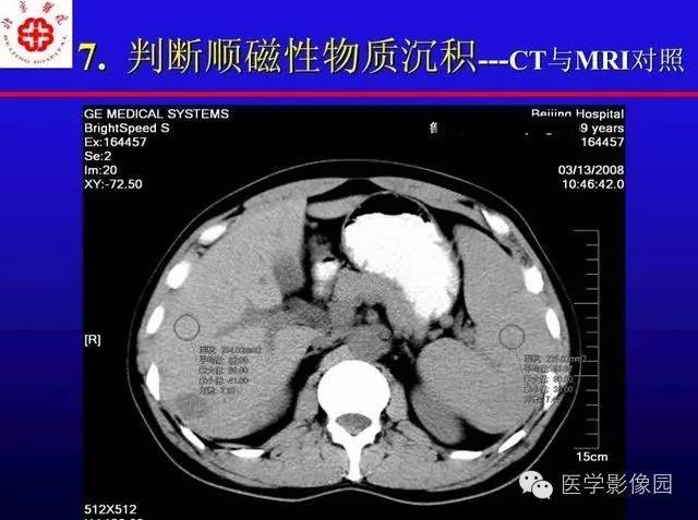 【PPT】MRI在腹部实质脏器病变诊断中的优势
