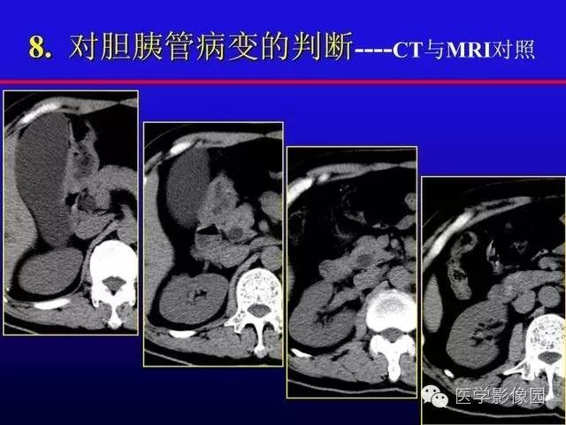 【PPT】MRI在腹部实质脏器病变诊断中的优势