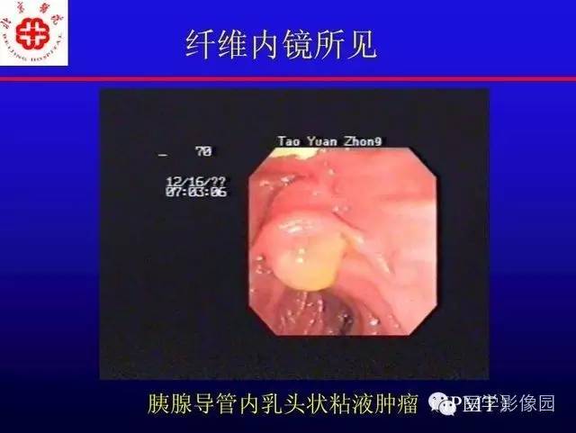 【PPT】MRI在腹部实质脏器病变诊断中的优势