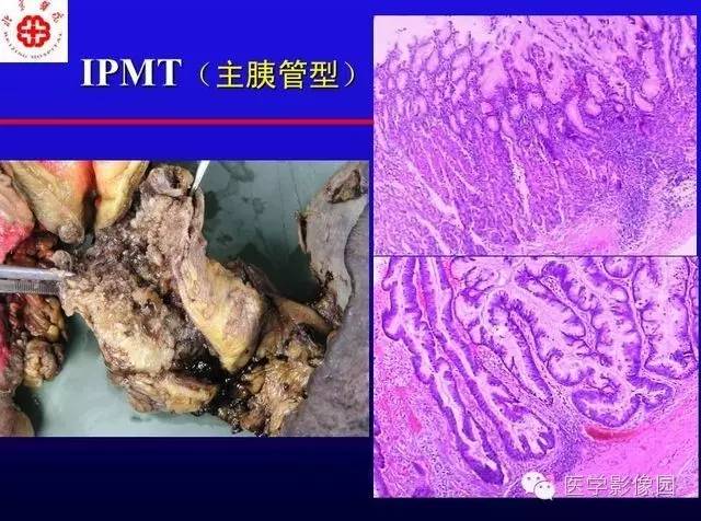 【PPT】MRI在腹部实质脏器病变诊断中的优势