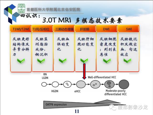 【PPT】HBV相关肝细胞癌演变MRI分级诊断