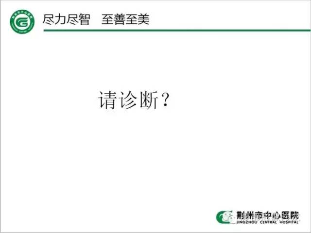 【病例】腹膜后血管瘤1例CT及MR影像表现