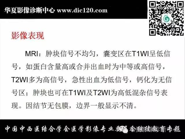 【PPT】颈部常见病变影像诊断