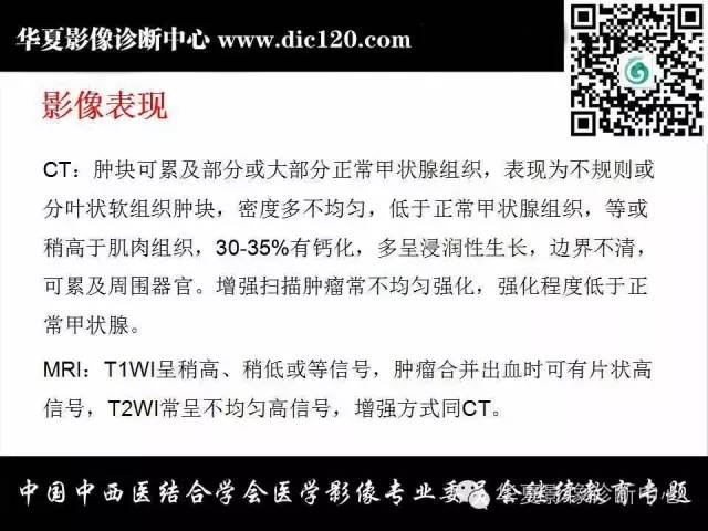 【PPT】颈部常见病变影像诊断